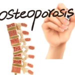 Understanding Bone Health: Osteopenia, Osteoporosis, and How to Support Stronger Bones